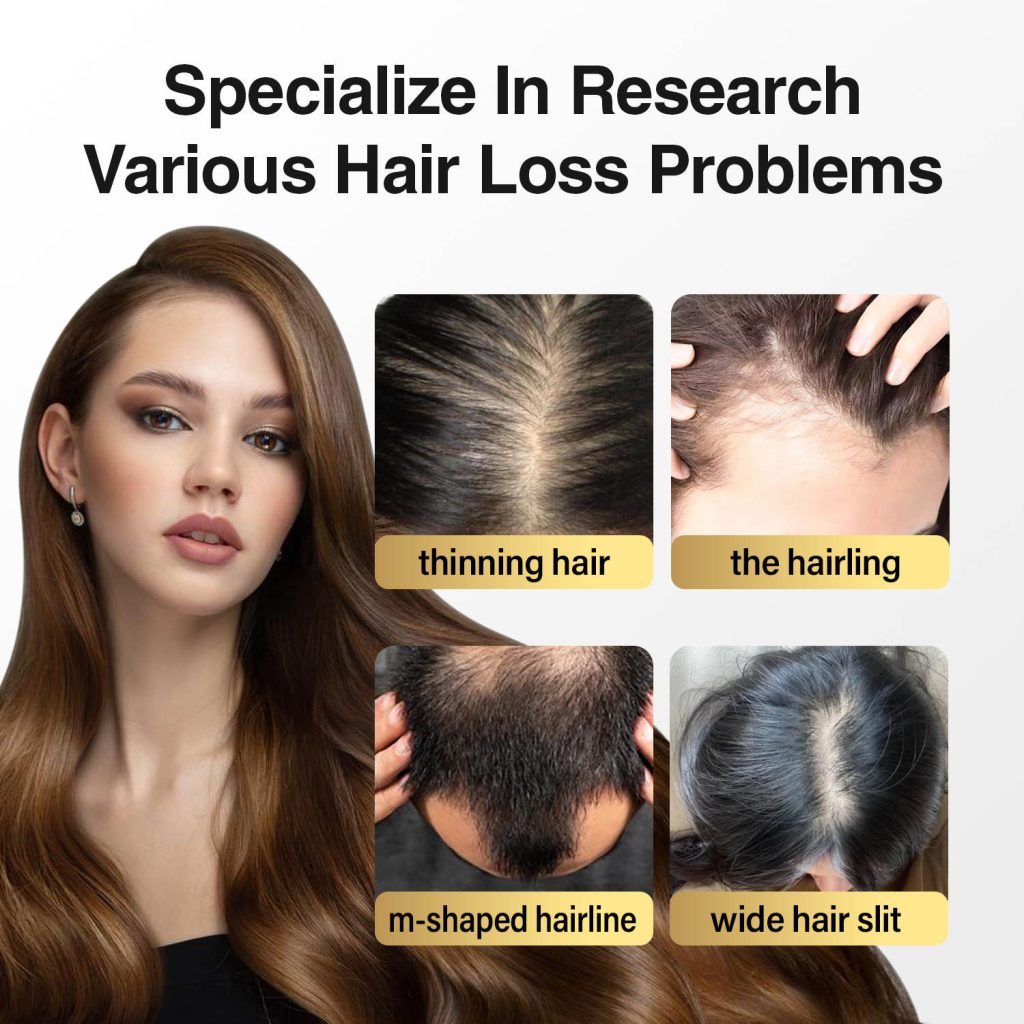 Image showing a woman with long hair alongside four photos depicting different hair loss issues: thinning hair, receding hairline, m-shaped hairline, and wide hair slit. Text highlights specialization in hair loss research.